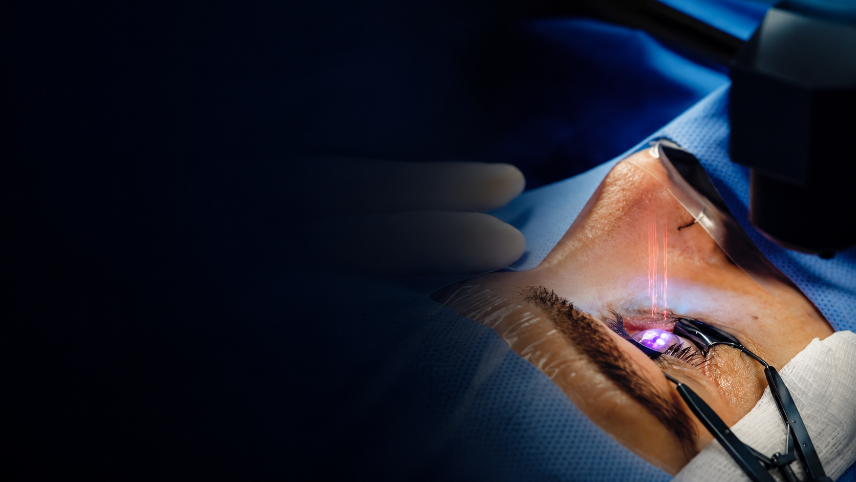 Cirurgia refrativa a laser em ambiente cirúrgico